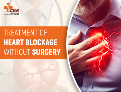 Treatment of Heart Blockage without Surgery: A Comprehensive Guide