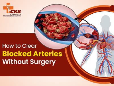 How to Clear Blocked Arteries Without Surgery
