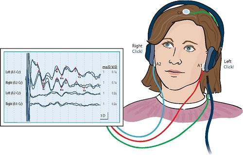 Evoked-Potentials