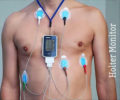 holter-monitoring