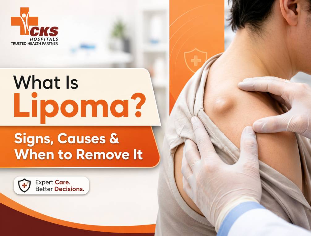 What Is Lipoma? Signs, Causes, and When to Remove It